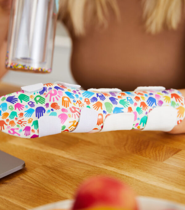 a manosplint splint in use whilst receiving hand therapy